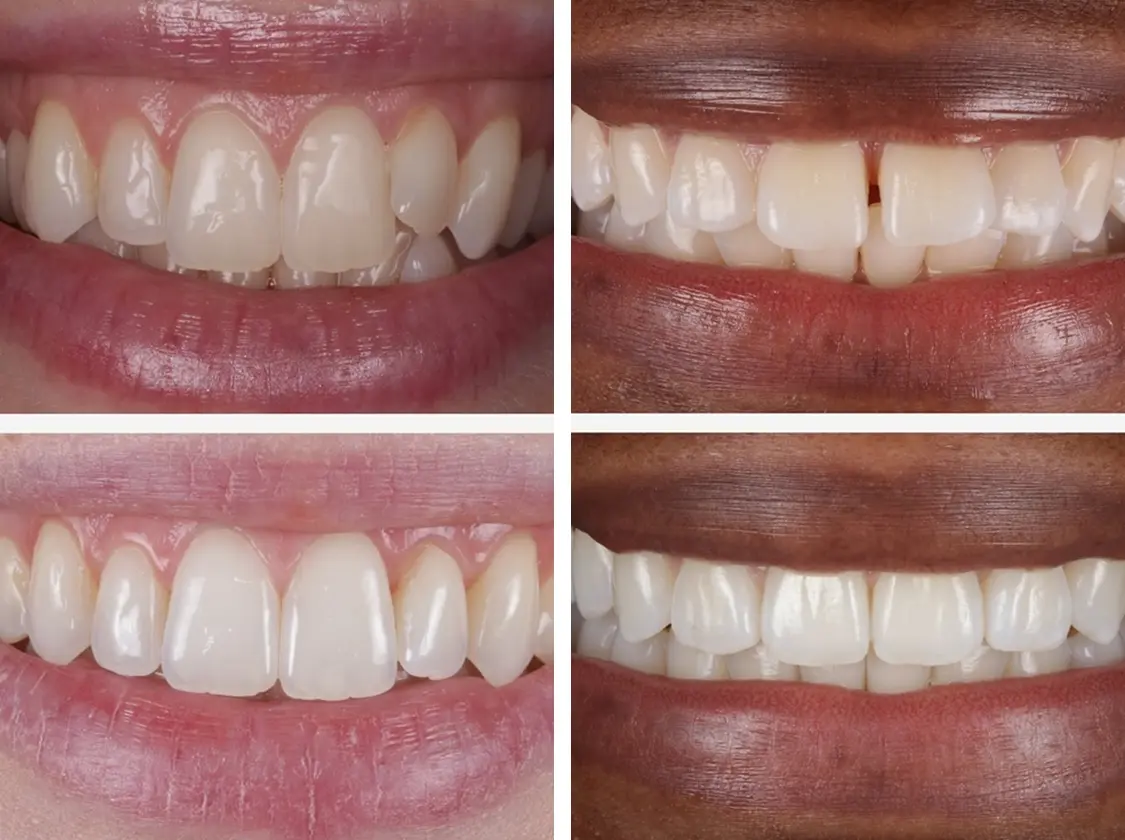 Comparison composite