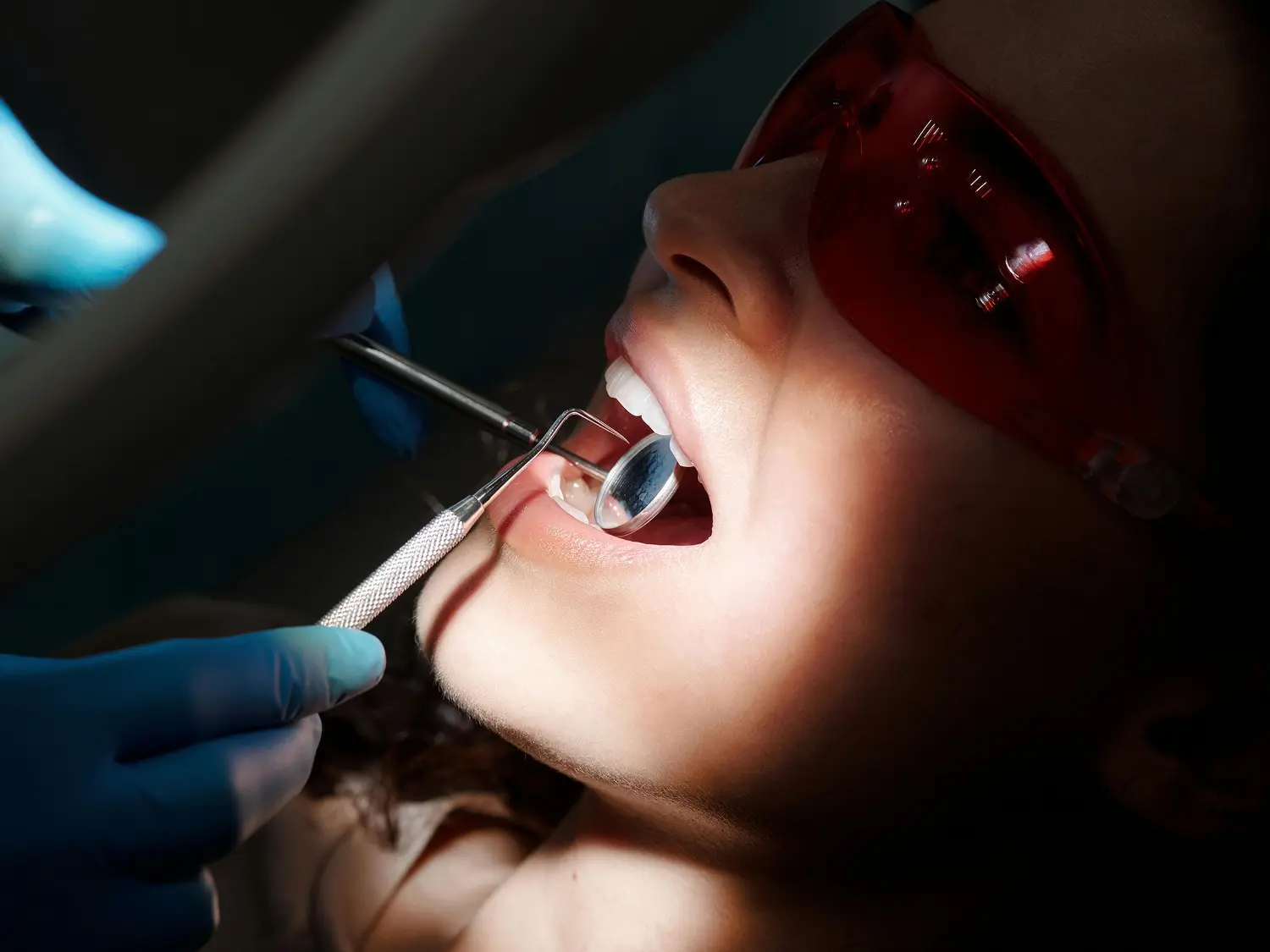 Composite bonding procedure